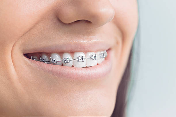 Best Teeth Whitening  in Exandria, AL